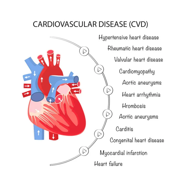 人的心脏和各种心血管疾病 实习生和医疗机构海报 关于医疗保健的病媒说明 — 图库矢量图片