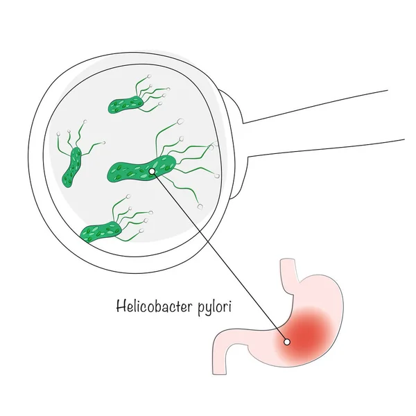 확대경 박테리아 — 스톡 벡터