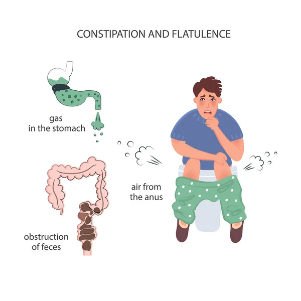 Constipation Flatulence Men Air Outlet Anus Gas Stomach Fecal Obstruction — ストックベクタ