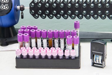 Birçok test tüpleri ile analiz laboratuvarı için hastalardan alınan kan