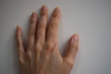 Kedi pençelerinin hafif arka plandaki kadın elinin derin çizikleri..