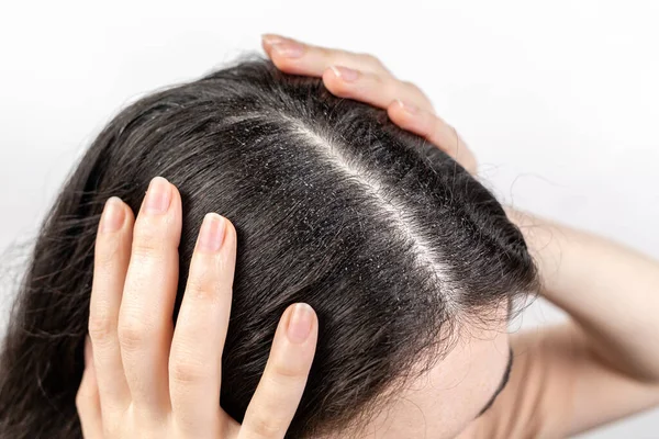 Mujer Sostiene Cabeza Con Las Manos Mostrando Una Separación Cabello —  Fotos de Stock