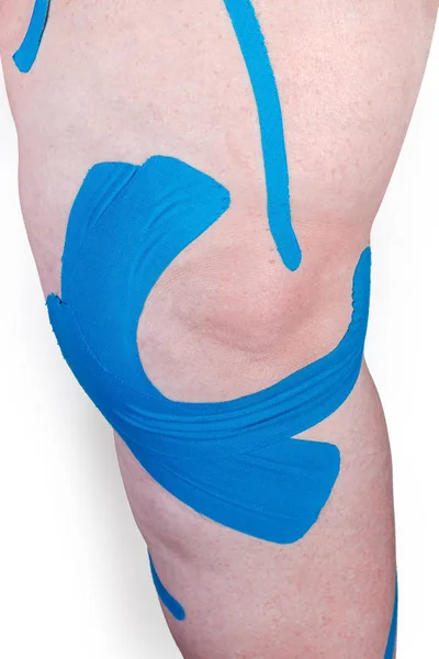 Blå elastiske terapeutiske bånd klistret omkring det kvindelige knæ - Stock-foto
