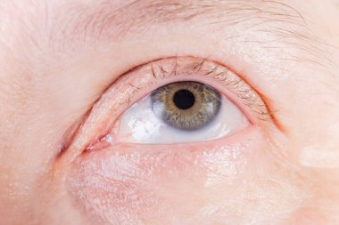 Küçük miktarlarda sarı renkli gri iris ile insan gözü ve sklera üzerinde bazı kan damarları, seçici odak noktasında yakın çekim