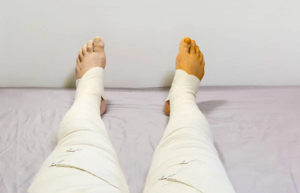 Вытянутые Человеческие Ноги Завернутые Тканые Эластичные Медицинские Бинты Закрепленные Зажимами — стоковое фото
