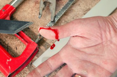 güvenlik önlemlerine uyulmaması, endüstriyel yaralanma.