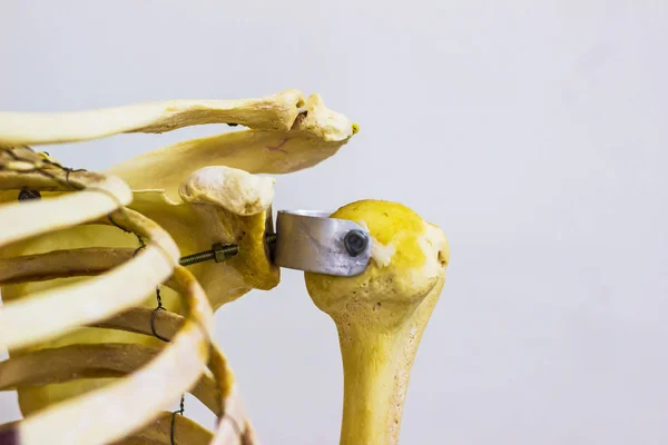 Clavícula de úmero articulada e ossos da escápula mostrando anatomia humana da articulação do ombro esquerdo em fundo branco — Fotografia de Stock