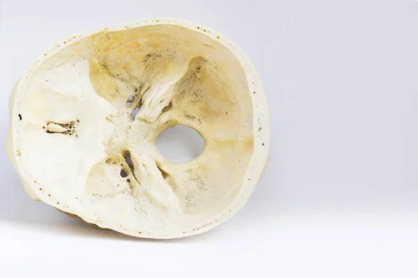 Vista Superior Base Del Cráneo Humano Mostrando Hueso Esfenoide Foramen — Foto de Stock