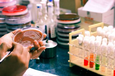 Bakteri aşılama aşılama döngü bilim adamı laboratuvar teknisyeni tarafından Mikrobiyoloji Laboratuvar olarak kullanarak bir kültür plaka üzerinde