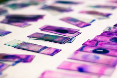 Hematoloji patolojisi laboratuarında mor leishman Giemsa lekesi ile periferik kan smear vitray slaytlar