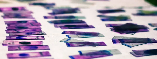 Hematoloji patolojisi laboratuarında mor leishman Giemsa lekesi ile periferik kan smear vitray slaytlar