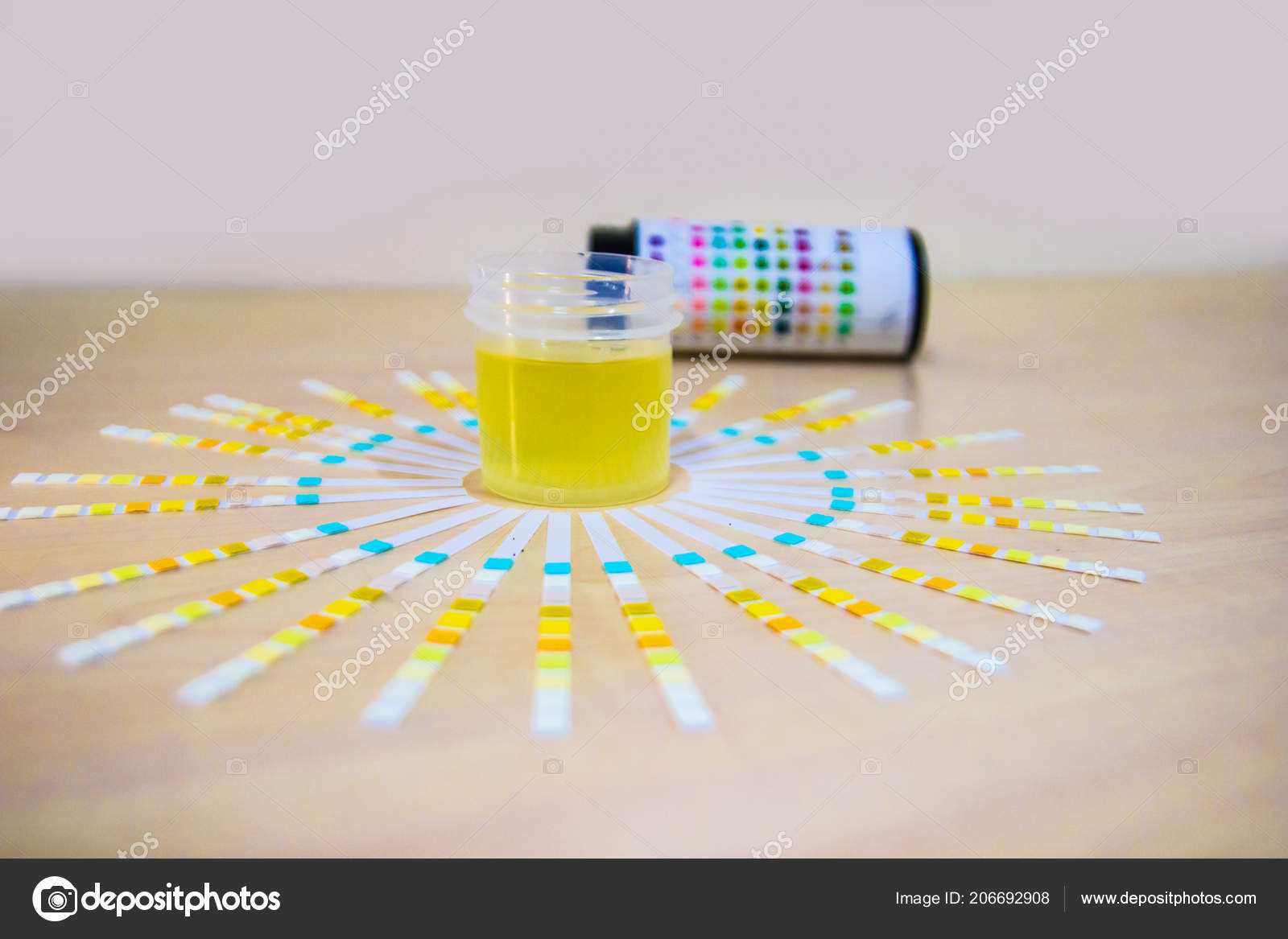 urinprov protein urinprov protein