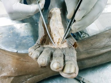 Patolojisi neşter makas ve forseps kesme deri kullanarak ayak gösterilen bir kadavra anatomi diseksiyon kapak ifşa önemli yapıları arterler damarlar sinirler