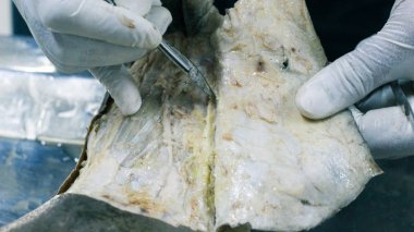 Patolojisi neşter makas ve forseps kesme deri kullanarak ayak gösterilen bir kadavra anatomi diseksiyon kapak ifşa önemli yapıları arterler damarlar sinirler