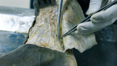 Patolojisi neşter makas ve forseps kesme deri kullanarak ayak gösterilen bir kadavra anatomi diseksiyon kapak ifşa önemli yapıları arterler damarlar sinirler