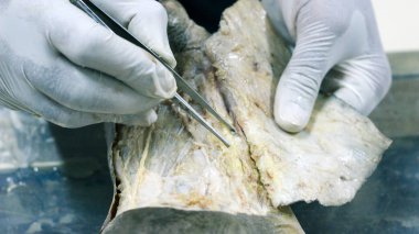 Patolojisi neşter makas ve forseps kesme deri kullanarak ayak gösterilen bir kadavra anatomi diseksiyon kapak ifşa önemli yapıları arterler damarlar sinirler