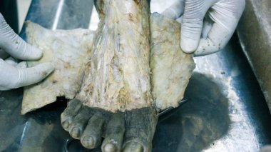 Patolojisi neşter makas ve forseps kesme deri kullanarak ayak gösterilen bir kadavra anatomi diseksiyon kapak ifşa önemli yapıları arterler damarlar sinirler