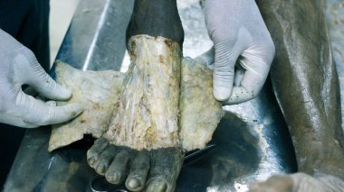 Patolojisi neşter makas ve forseps kesme deri kullanarak ayak gösterilen bir kadavra anatomi diseksiyon kapak ifşa önemli yapıları arterler damarlar sinirler