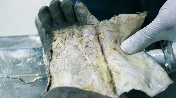 Patolojisi neşter makas ve forseps kesme deri kullanarak ayak gösterilen bir kadavra anatomi diseksiyon kapak ifşa önemli yapıları arterler damarlar sinirler