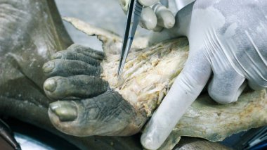 Patolojisi neşter makas ve forseps kesme deri kullanarak ayak gösterilen bir kadavra anatomi diseksiyon kapak ifşa önemli yapıları arterler damarlar sinirler