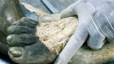 Patolojisi neşter makas ve forseps kesme deri kullanarak ayak gösterilen bir kadavra anatomi diseksiyon kapak ifşa önemli yapıları arterler damarlar sinirler