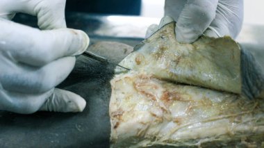 Patolojisi neşter makas ve forseps kesme deri kullanarak ayak gösterilen bir kadavra anatomi diseksiyon kapak ifşa önemli yapıları arterler damarlar sinirler