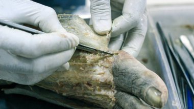 Patolojisi neşter makas ve forseps kesme deri kullanarak ayak gösterilen bir kadavra anatomi diseksiyon kapak ifşa önemli yapıları arterler damarlar sinirler