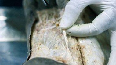 Patolojisi neşter makas ve forseps kesme deri kullanarak ayak gösterilen bir kadavra anatomi diseksiyon kapak ifşa önemli yapıları arterler damarlar sinirler