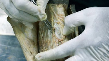 Patolojisi neşter makas ve forseps kesme deri kullanarak ayak gösterilen bir kadavra anatomi diseksiyon kapak ifşa önemli yapıları arterler damarlar sinirler