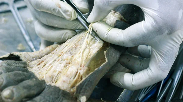 Disección Anatomía Cadáver Que Muestra Dorso Del Pie Usando Tijeras — Foto de Stock