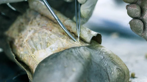 Disección Anatomía Cadáver Que Muestra Dorso Del Pie Usando Tijeras — Foto de Stock