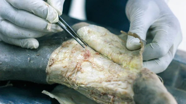 Anatomická Pitva Mrtvoly Ukazující Dorsum Nohy Pomocí Skalpelu Nůžky Kleště — Stock fotografie