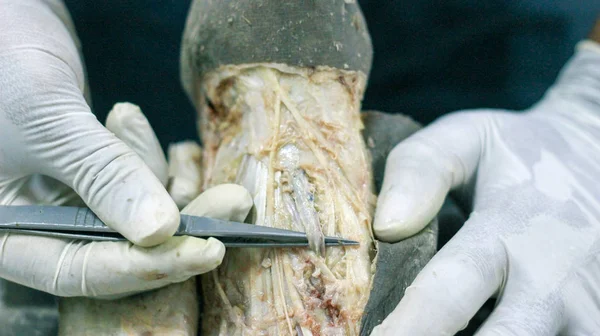 Anatomická Pitva Mrtvoly Ukazující Dorsum Nohy Pomocí Skalpelu Nůžky Kleště — Stock fotografie