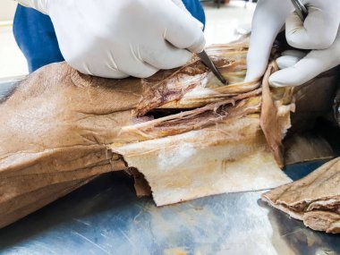 Bir kadavra gösteren adductor anatomi diseksiyon kanal neşter makas ve cilt kapağı önemli yapıları arterler damarlar sinirler açığa kesme forseps kullanarak