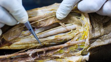 Bir kadavra gösteren adductor anatomi diseksiyon kanal neşter makas ve cilt kapağı önemli yapıları arterler damarlar sinirler açığa kesme forseps kullanarak