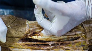 Bir kadavra gösteren adductor anatomi diseksiyon kanal neşter makas ve cilt kapağı önemli yapıları arterler damarlar sinirler açığa kesme forseps kullanarak