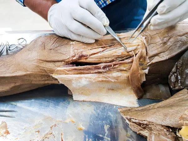 Anatomi Dissekering Cadaver Visar Adductor Kanalen Med Hjälp Skalpell Sax — Stockfoto