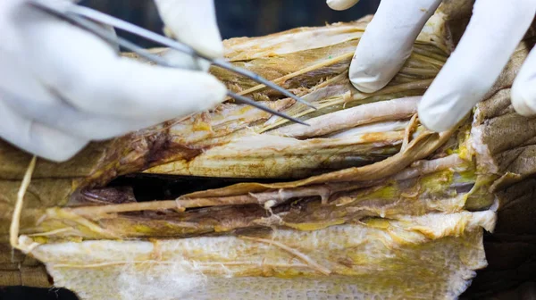 Anatomy dissection of a cadaver showing adductor canal using scalpel scissors and forceps cutting skin flap revealing important structures arteries veins nerves