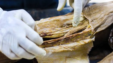 Bir kadavra gösteren adductor anatomi diseksiyon kanal neşter makas ve cilt kapağı önemli yapıları arterler damarlar sinirler açığa kesme forseps kullanarak