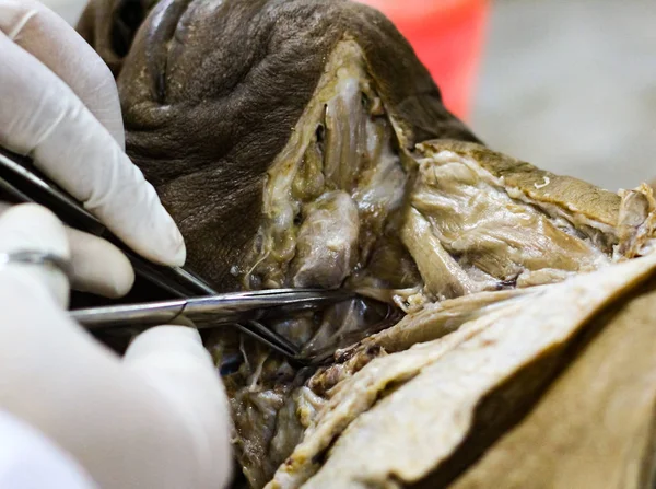 Retsmedicinsk Anatomi Dissektion Kadaver Viser Hoved Hals Område - Stock-foto