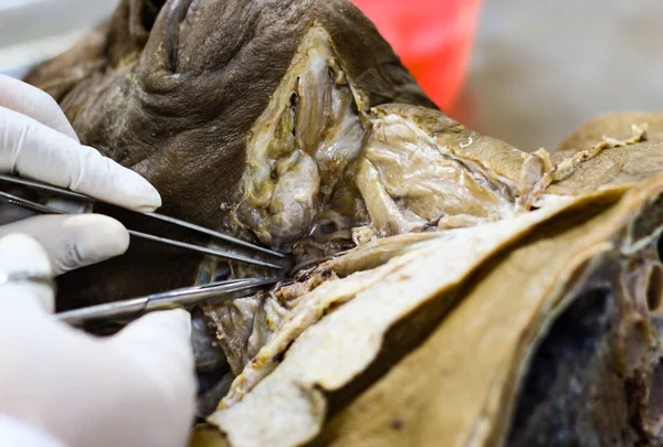 Disección Anatomía Forense Cadáver Con Área Cabeza Cuello — Foto de Stock