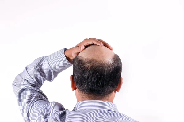 Homem Negócios Careca Com Cabeça Vista Couro Cabeludo Por Trás — Fotografia de Stock