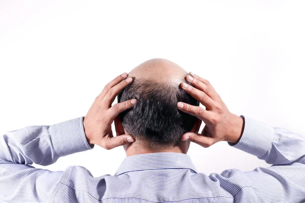 Glatzköpfiger Geschäftsmann Mit Kopf Auf Kopfhaut Von Hinten Mit Weißem — Stockfoto