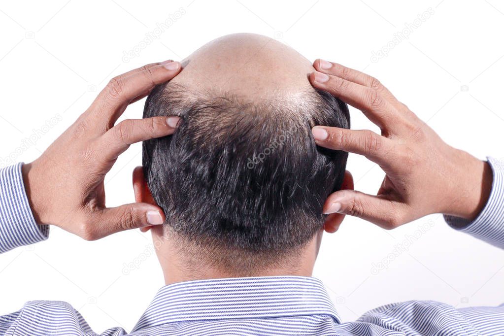 bald businessman with his head on scalp view from behind with white background