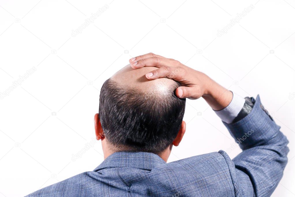 bald businessman with his head on scalp view from behind with white background