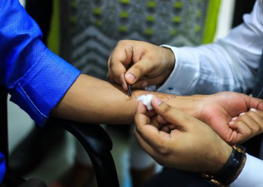 Cilt Anti test hazırlık doktor cilt prick lancet kullanarak bir hasta elde tarafından