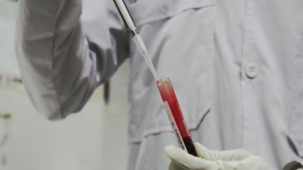 Científico Médico Extrae Sangre Tubo Muestra Con Una Micropipeta — Vídeos de Stock