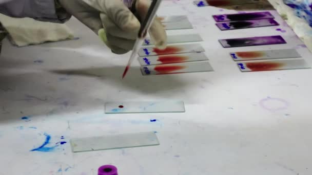 Een Patholoog Gehandschoende Hand Trekt Een Bloeduitstrijkje Een Glazen Glijbaan — Stockvideo