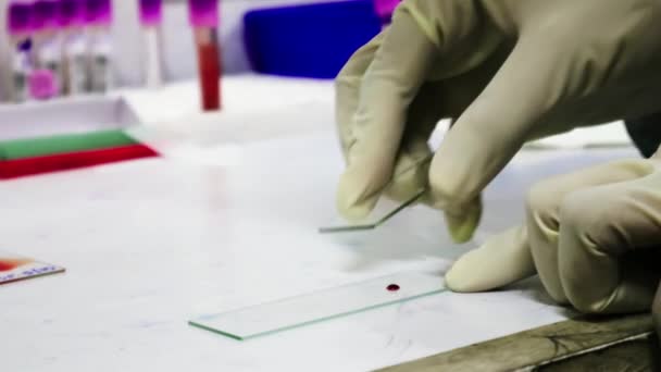一个病理学家戴手套的手准备画一个血涂片上的玻璃幻灯片 — 图库视频影像
