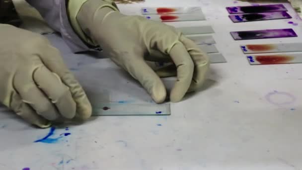 一个戴手套的病理学家在玻璃滑梯上画血污迹 — 图库视频影像